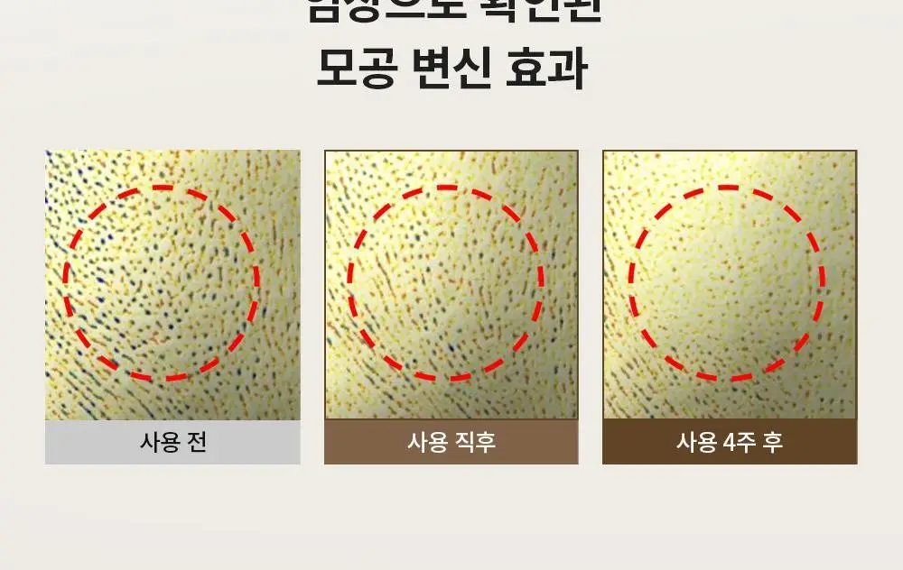 [원조율무팩] 리터니티 율무 요철모공 팩 120g 기획세트 상세페이지 35